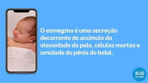 smegma image|Esmegma: o que é, sintomas, causas e tratamento